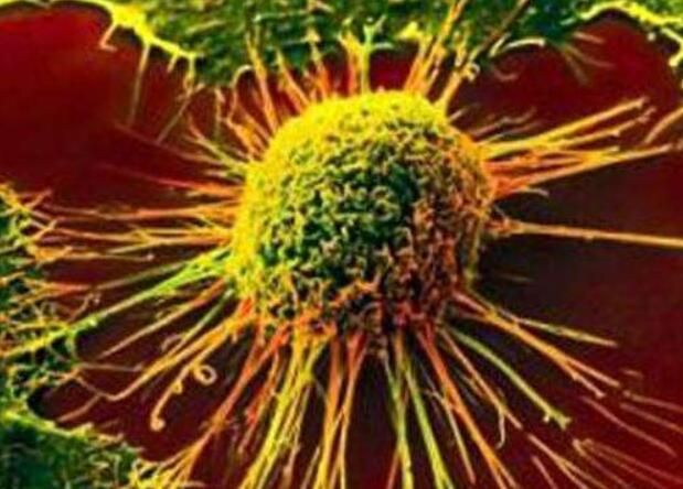 科学家有望开展首个肺癌免疫疗法人体试验